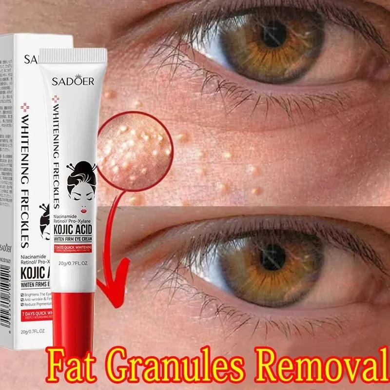 Fat Granules Remover Eye Cream Anti Puffiness Inflammatory Firm Cream Reduce Dark Circle Fade Fines Line Repair Barrier Eye Skin